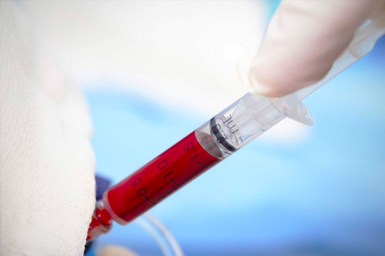 Intraoperative-Blood-Management